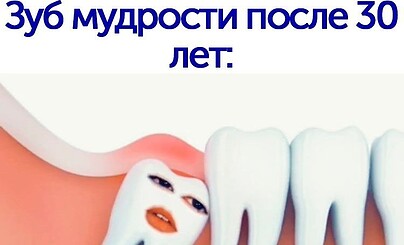 Как я у стоматолога побывал